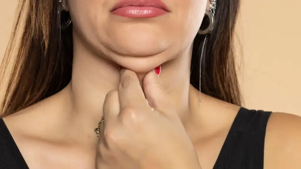 An image of a woman with double chin, sad, worried : Non Surgical Double Chin Removal Treatment in Kings Hill, UK