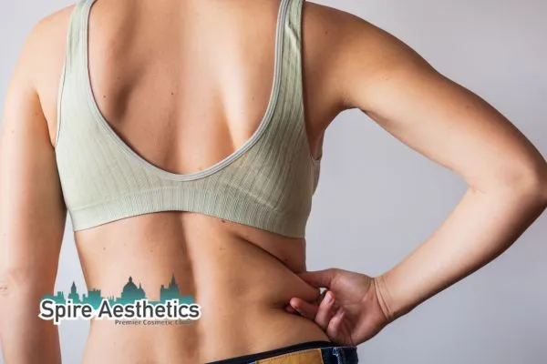Learn how to reduce and remove love handles Kings Hill Call our team today!