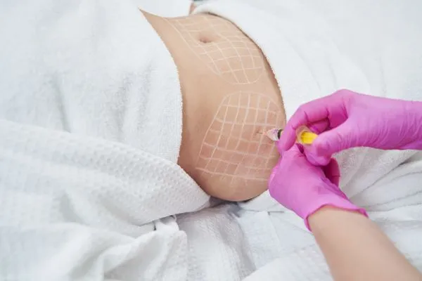 image of fat dissolving injections on love handles to help combat weight gain Kings Hill