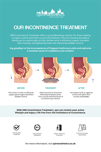 image to show how EMS treatment works for female urinary incontinence Kings Hill