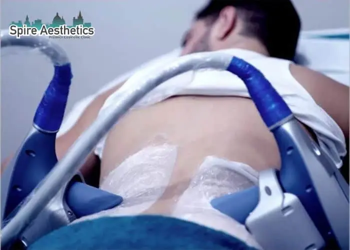 Man having fat freezing treatment done on love handles before a competitions Kings Hill to create a sculpted look.